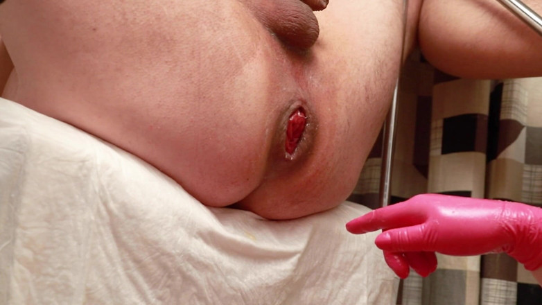 Marcus Pollack: Rosebutt pompen