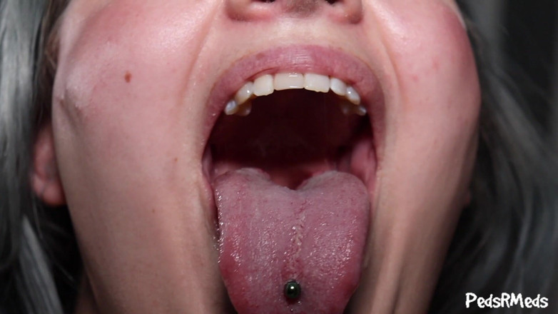 PedsRMeds: Shortlivedtyranny and Thooks Throat Check