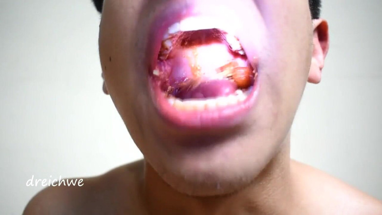 Dreichwe: Eating episode 7