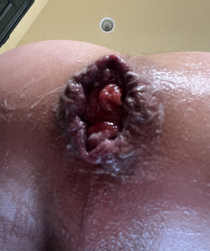 Stacey Loves Anal xxx: Esticou a bunda anal