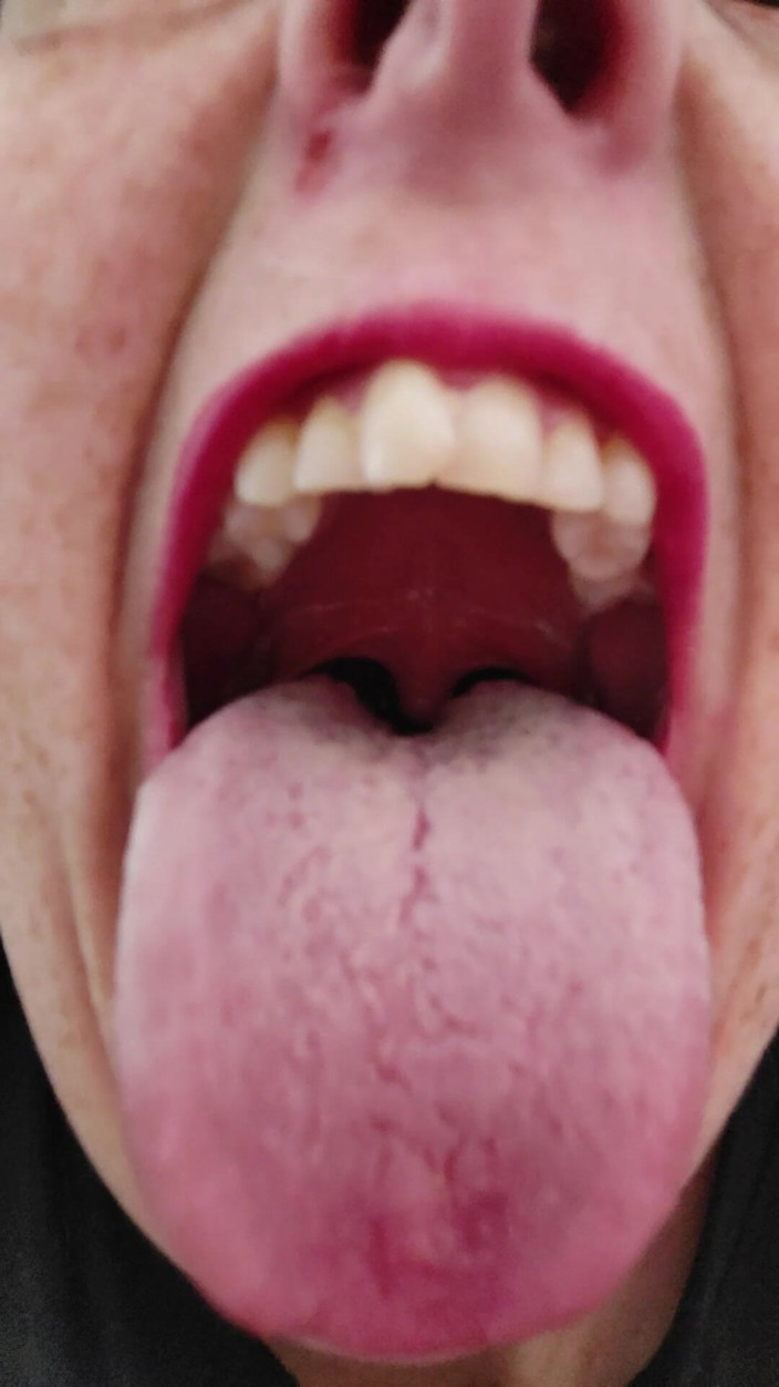 AngYourDirtyCanadian: Close up of My Mouth and Tongue