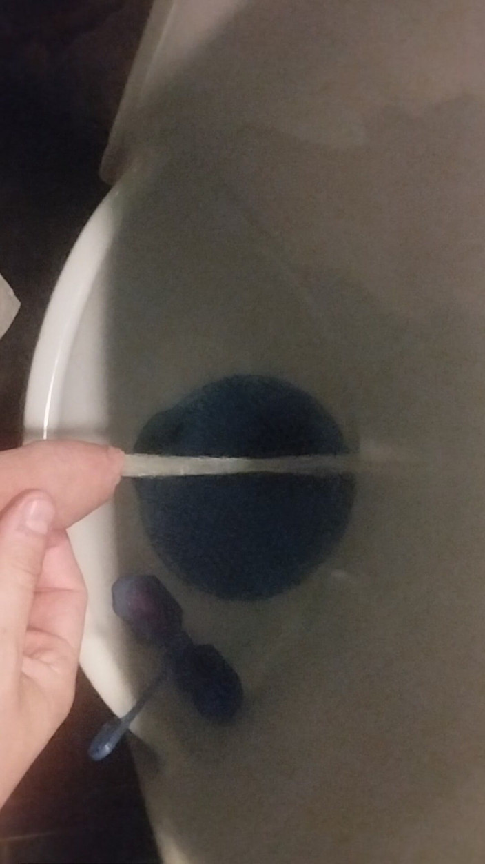 Bayer911: Bayer, partie 152