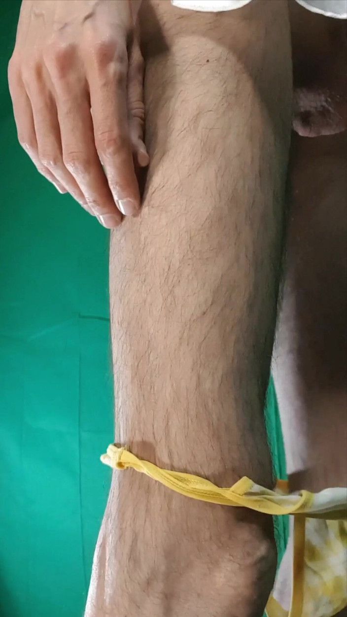 HeIsSooThin: String à carreaux jaunes et chemise de nuit blanche en satin