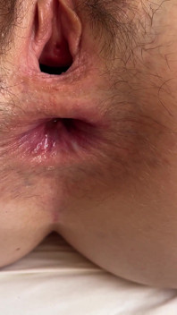 MILF Lông Hậu Môn ASMR