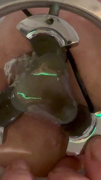 Pouring Hot Candle Wax Into Ass