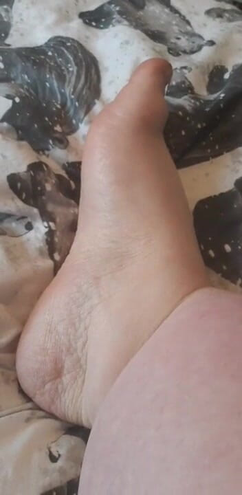 SSBBWLadyBrads: เท้าอ้วนอวบ