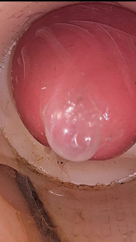 Camera din pizda adâncă înregistrează o ejaculare imensă de spermă în prezervativ