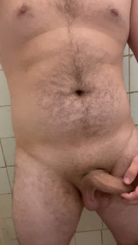 My Hairy Body