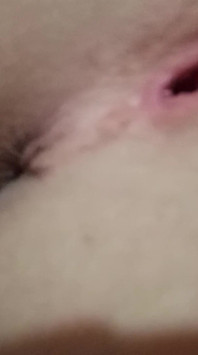 非常に暑い