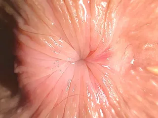 Extreme Close up: Teenage Butthole Is Trying to Kiss You Trough the Screen of Your Iphone