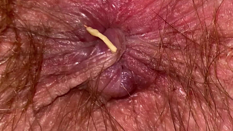 Cuteblonde666: Video fetish gergasi dengan dubur berbulu rakaman dekat yang melampau