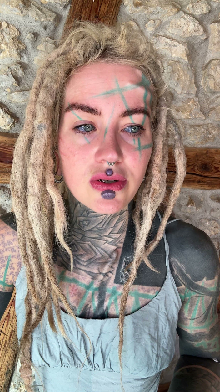 Anuskatzz: I Got New Boobs and an Upper Blephoplasty. in This...