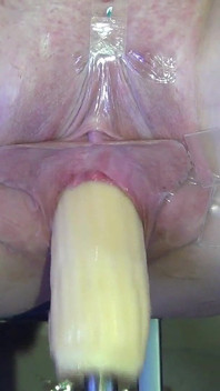 Wide Open Cocked Pussy Mechanically Fucked From Very Close 1