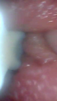Endoscoopcamera toont de meest gevoelige delen van de penis educatieve video