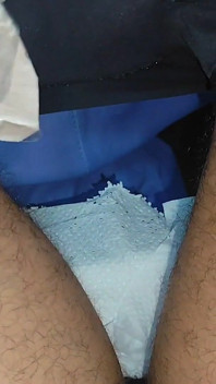 The Dick Had to Be Implanted Slowly.