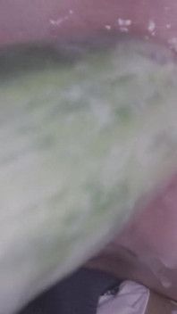Anal Destruction