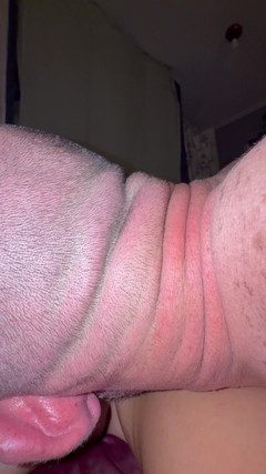 Canccr: Pregătindu-l