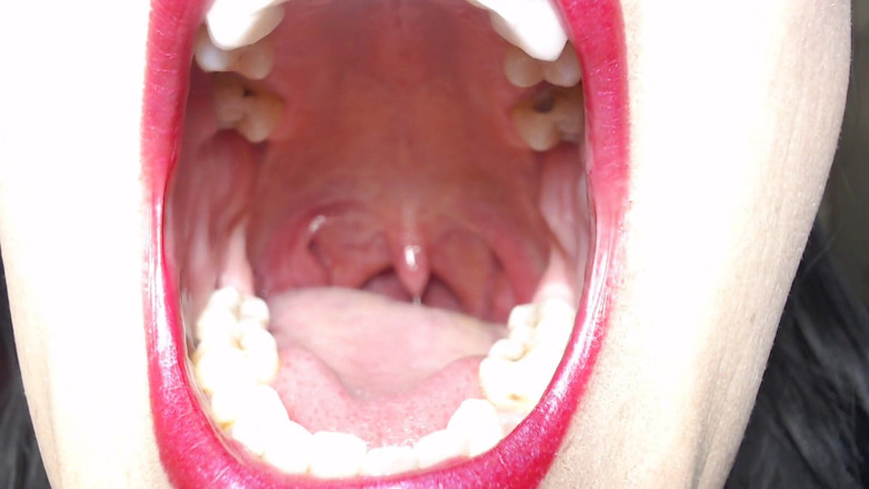 Abby Anna: Big wide open mouth
