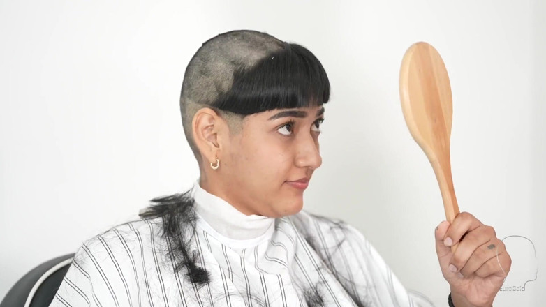 Euro Bald: Hindi