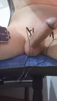 E-stim Hfo