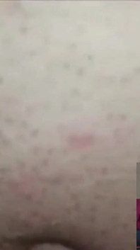 Sie Spielt Vor Der Webcam Mit Seinem Schwanz