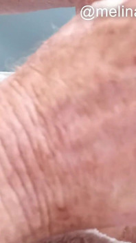 Anal Polishing