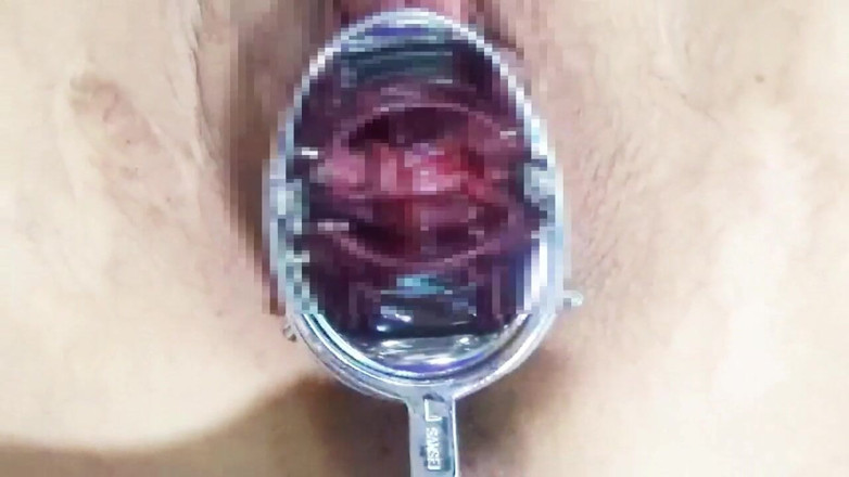 Cattish Brain78: Using a Speculum to Spread an M-woman's Pussy, Anal Training　1/2