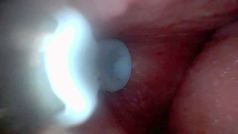 Twittiy: Lass Uns Zusammen Einen Blick in Meine Saftige Muschi Werfen (endoskopische...