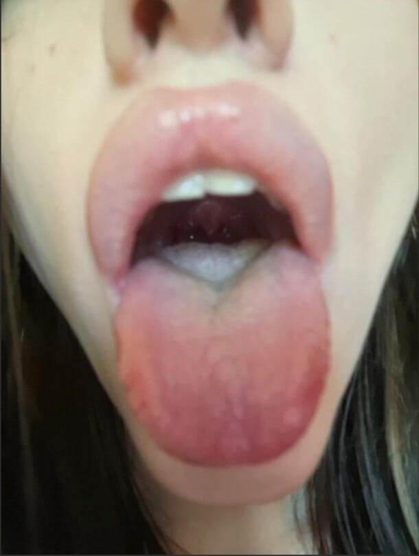 ElzaKom: I'm Young, but I Love Being with Older Men