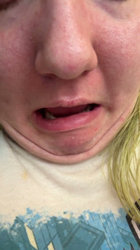 Chin Faces
