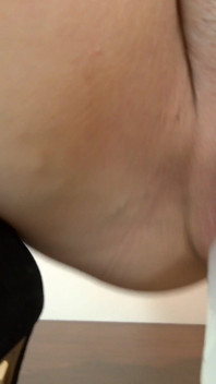 The Essence of Nylon Kink
