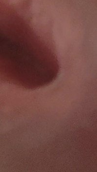 Amazing Closeup of the Widened Hole!!