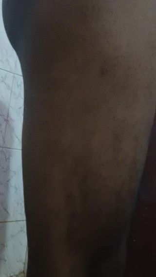 shapemodel: Hairy Ass