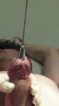 Massive Treatment