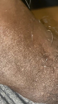 Meat Teaser