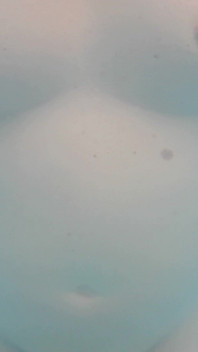 Pechos En La Piscina