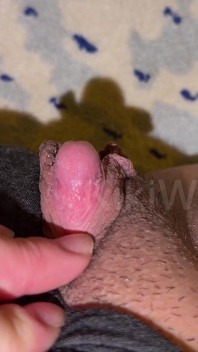 Dirty Big Clit Smegma Asian Ftm Teasing