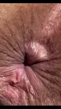 Lubang anal close-up, Anda dapat melihat semua rambutnya. Pantatnya berbulu, sering disetubuhi oleh seks anal. Bagian 1