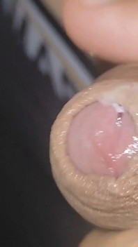 놀라운 업라이트 인정사정 모르는 Venous Frenulum