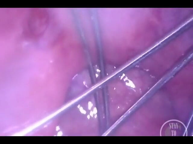 Lina Free: Whisk întinzându-mi curul din interior