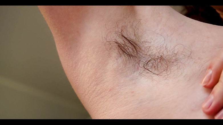 Medi Voi: I Know There Are Hairy Armpits Fans