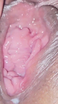阴户扩张激情