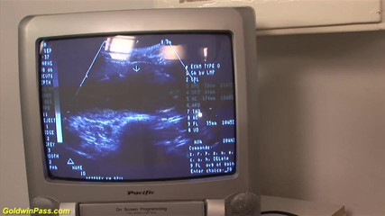 Crazy Pregnant: Preggo berambut merah disetubuhi di klinik