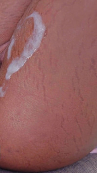 The Sneaky Link Always Comes Correct