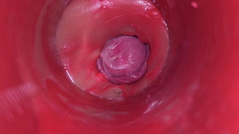 Ladybottox: กล้องในหี: ทรงพลังแตกในหี! Asmr ภายในที่ดีที่สุด