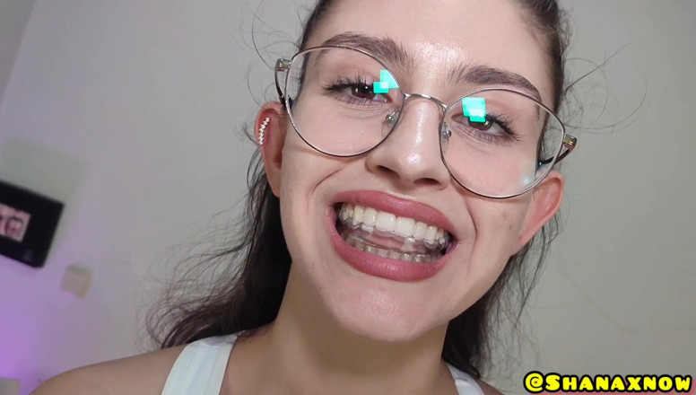Shanaxnow: Mi fetiche ortodóntico sujetador lengua dientes