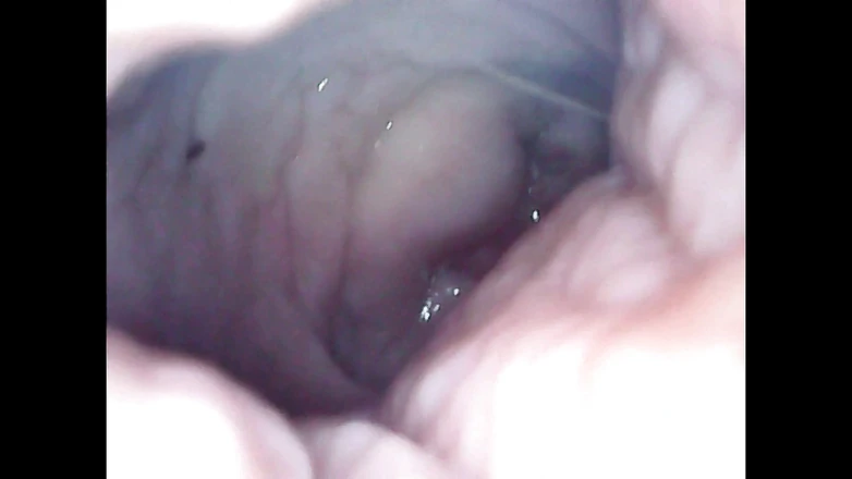LizAngel: I masturbate with an endoscope in my vagina