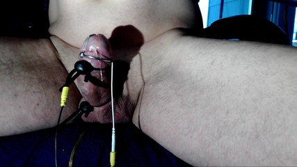 camaro6702: 2b Stříkací dilatátor