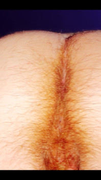 Hairy Butt of a 5-month Pregnant Woman