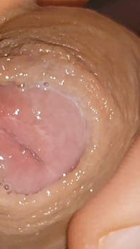 Le Liquide Urétral En Grande Quantité Le Rend Glissant.